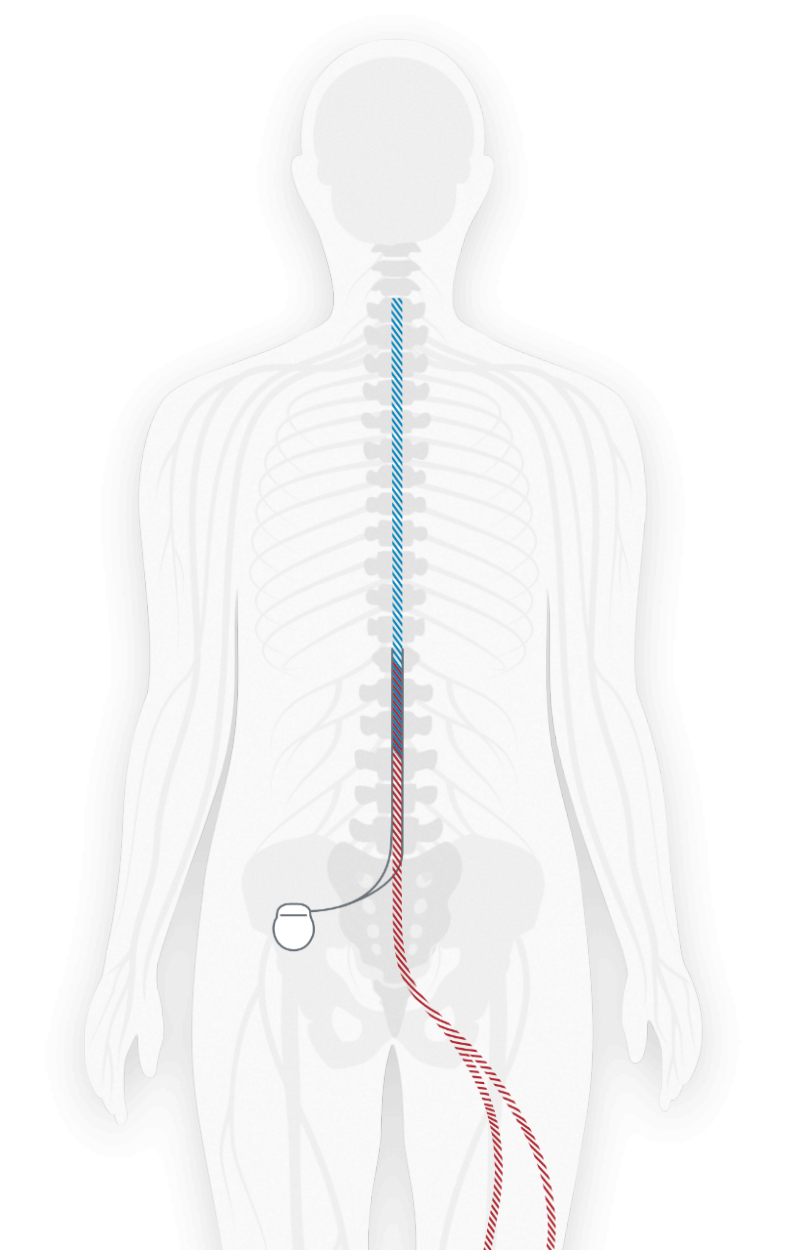 Spinal Cord Graphic